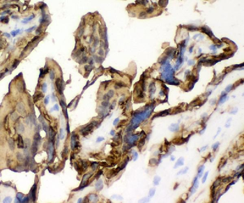 Anti-Glucose Transporter GLUT1/SLC2A1 Antibody