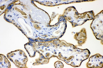 Anti-Glucose Transporter GLUT1/SLC2A1 Antibody