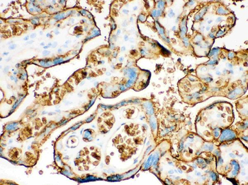 Anti-Glucose Transporter GLUT1/SLC2A1 Antibody