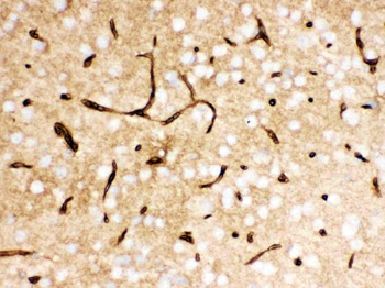 Anti-Glucose Transporter GLUT1/SLC2A1 Antibody