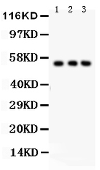 Anti-Glucose Transporter GLUT2/SLC2A2 Antibody