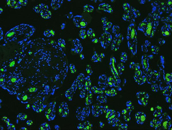 Anti-SLC4A1/CD233/Band 3 Antibody