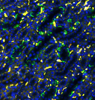 Anti-SLC4A1/CD233/Band 3 Antibody