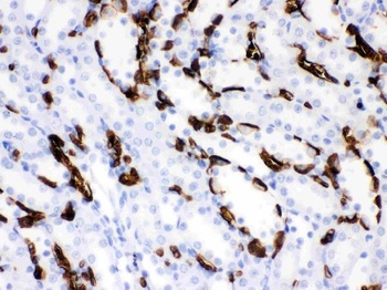 SLC4A1/CD233/Band 3 Antibody