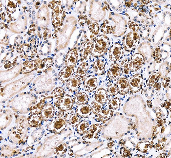 Anti-SLC4A1/CD233/Band 3 Antibody