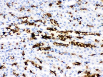 SLC4A1/CD233/Band 3 Antibody