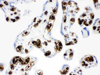 Anti-SLC4A1/CD233/Band 3 Antibody