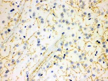Anti-Serotonin transporter/SLC6A4 Antibody