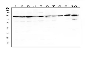 Anti-Serotonin transporter/SLC6A4 Antibody