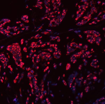 Anti-SNRPN Antibody