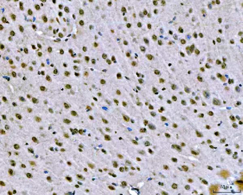 Anti-SNRPN Antibody
