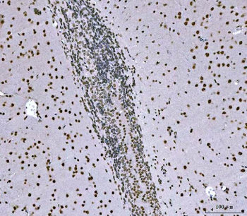 Anti-SNRPN Antibody