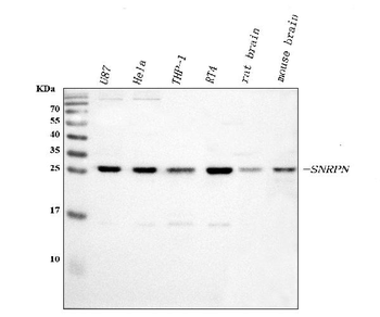 Anti-SNRPN Antibody