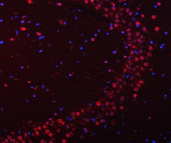 Anti-SNRPN Antibody