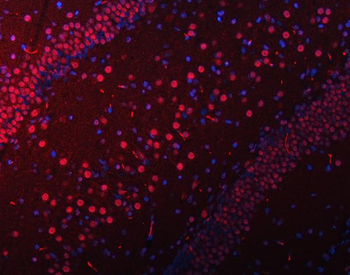 Anti-SNRPN Antibody