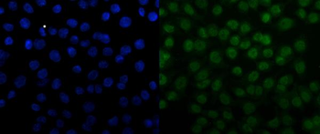 Anti-SNRPN Antibody