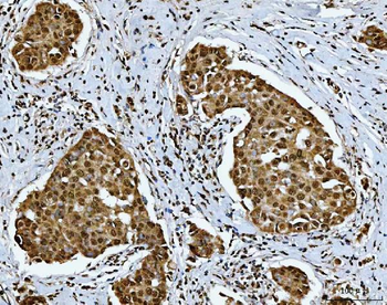 Anti-SNRPN Antibody