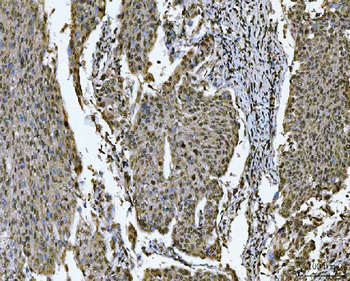 Anti-SNRPN Antibody