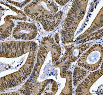 Anti-SNRPN Antibody