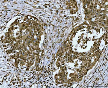 Anti-SNRPN Antibody