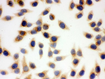 Anti-SOD2 Antibody