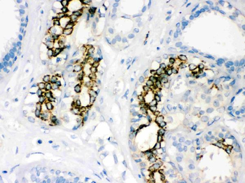 Anti-SOD2 Antibody