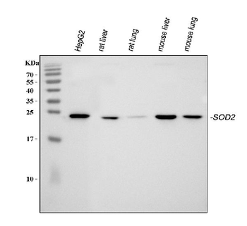 Anti-SOD2 Antibody