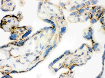 Anti-Transglutaminase 2/TGM2 Antibody
