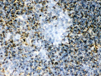 Anti-Transglutaminase 2/TGM2 Antibody