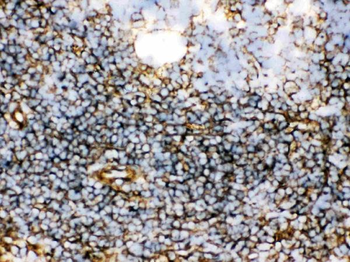 Anti-Transglutaminase 2/TGM2 Antibody