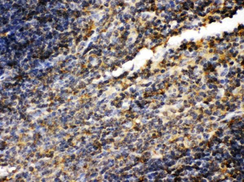 Anti-Transglutaminase 2/TGM2 Antibody