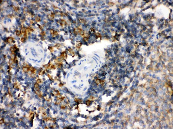 Anti-Transglutaminase 2/TGM2 Antibody