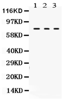 Anti-Transglutaminase 2/TGM2 Antibody