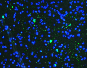 Anti-Tyrosine Hydroxylase/TH Antibody