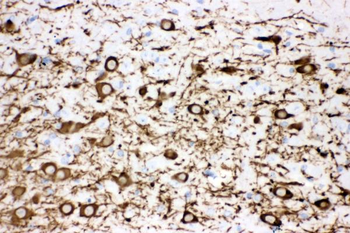 Anti-Tyrosine Hydroxylase/TH Antibody