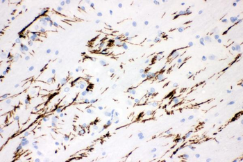 Anti-Tyrosine Hydroxylase/TH Antibody
