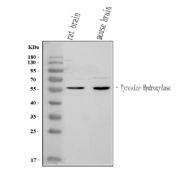 Anti-Tyrosine Hydroxylase/TH Antibody
