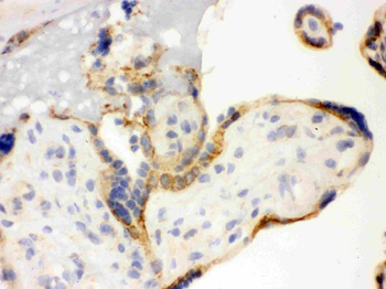 Anti-TLR7 Antibody