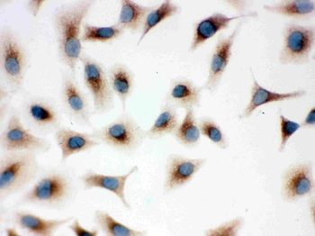 Anti-TLR7 Antibody