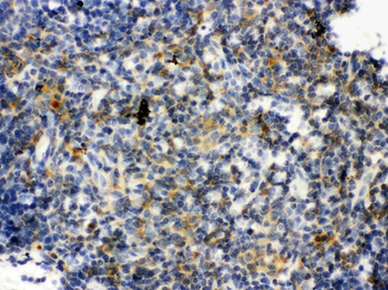 Anti-TLR7 Antibody