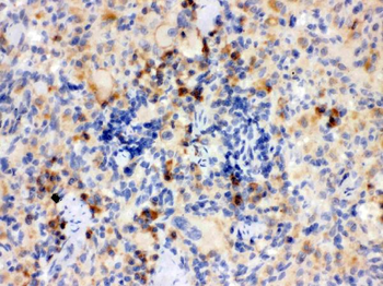 Anti-TLR7 Antibody