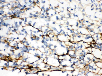 Versican/VCAN Antibody