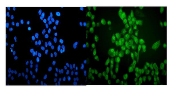 Anti-VCP Antibody