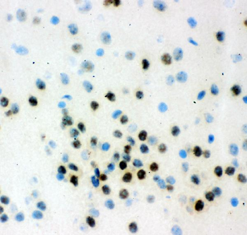 Anti-VCP Antibody