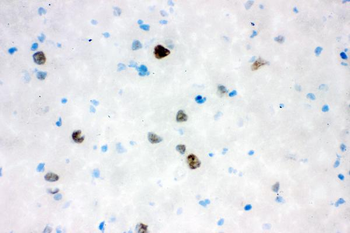 Anti-VCP Antibody