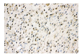 Anti-VCP Antibody