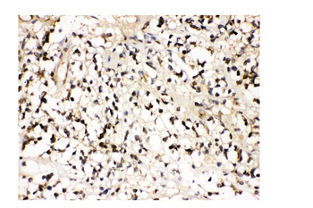 Anti-VCP Antibody