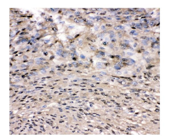 Anti-VCP Antibody
