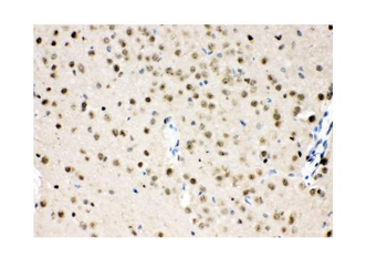 Anti-VCP Antibody