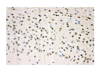 Anti-VCP Antibody